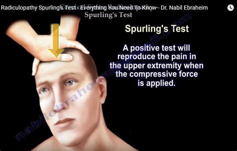 spurling test cervical spine